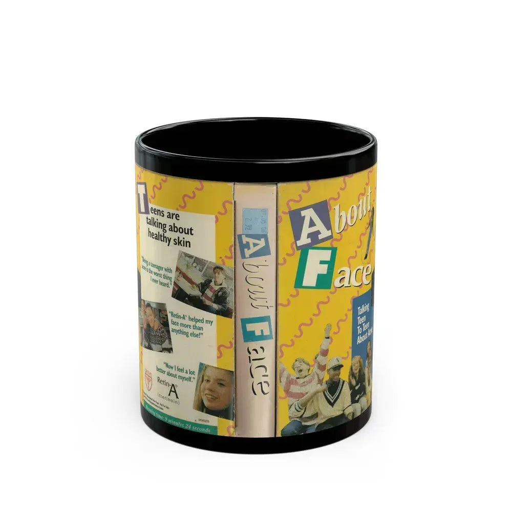 ABOUT FACE TALKING TEEN TO TEEN ABOUT ACNE (VHS COVER) - Black Coffee Mug 11oz - Go Mug Yourself