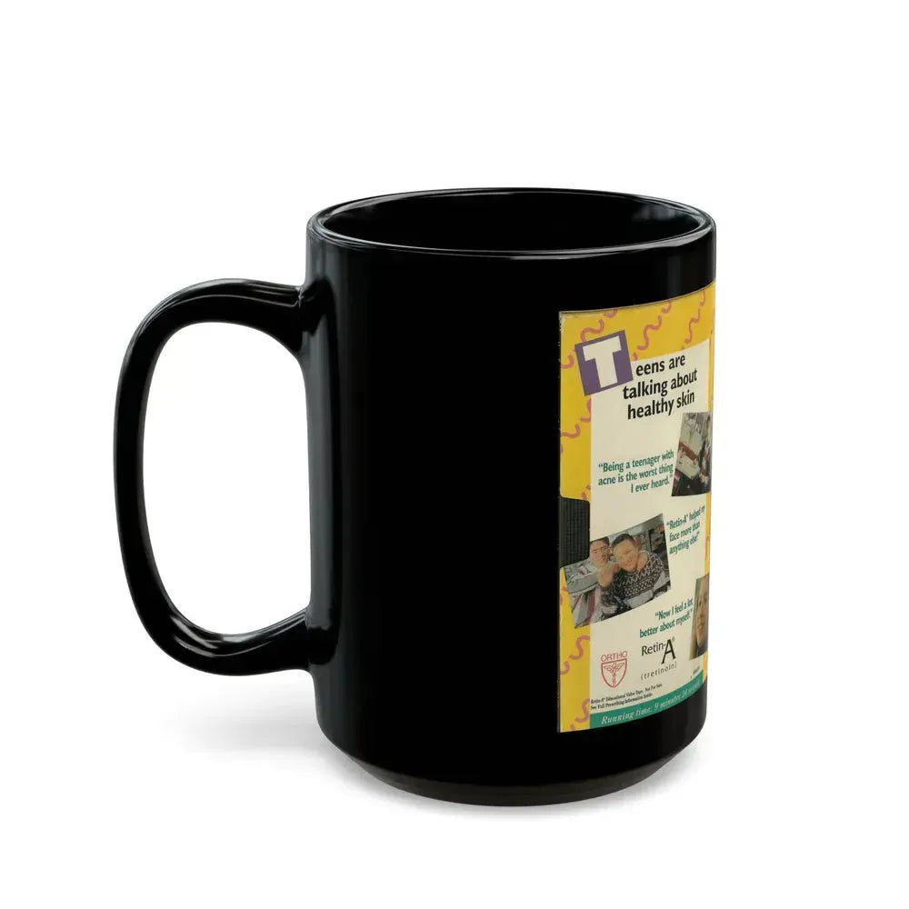 ABOUT FACE TALKING TEEN TO TEEN ABOUT ACNE (VHS COVER) - Black Coffee Mug - Go Mug Yourself