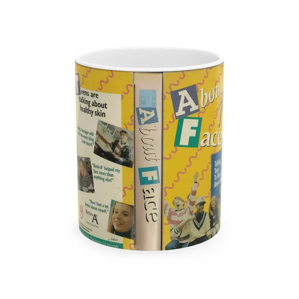 ABOUT FACE TALKING TEEN TO TEEN ABOUT ACNE (VHS COVER) - White Coffee Mug 11oz - Go Mug Yourself