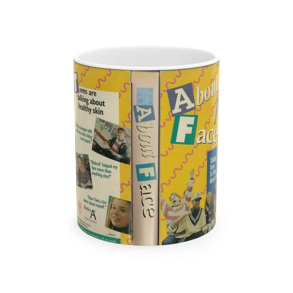 ABOUT FACE TALKING TEEN TO TEEN ABOUT ACNE (VHS COVER) - White Coffee Mug-11oz-Go Mug Yourself