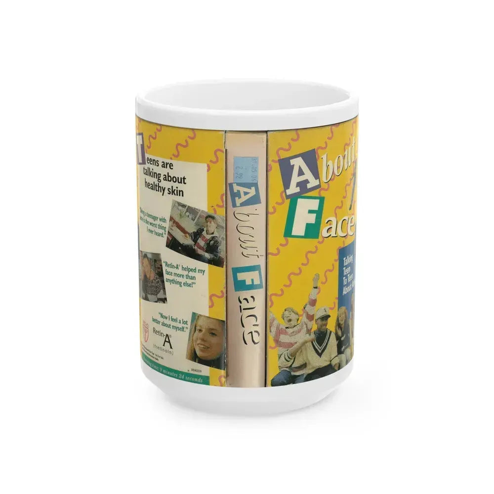 ABOUT FACE TALKING TEEN TO TEEN ABOUT ACNE (VHS COVER) - White Coffee Mug 15oz - Go Mug Yourself