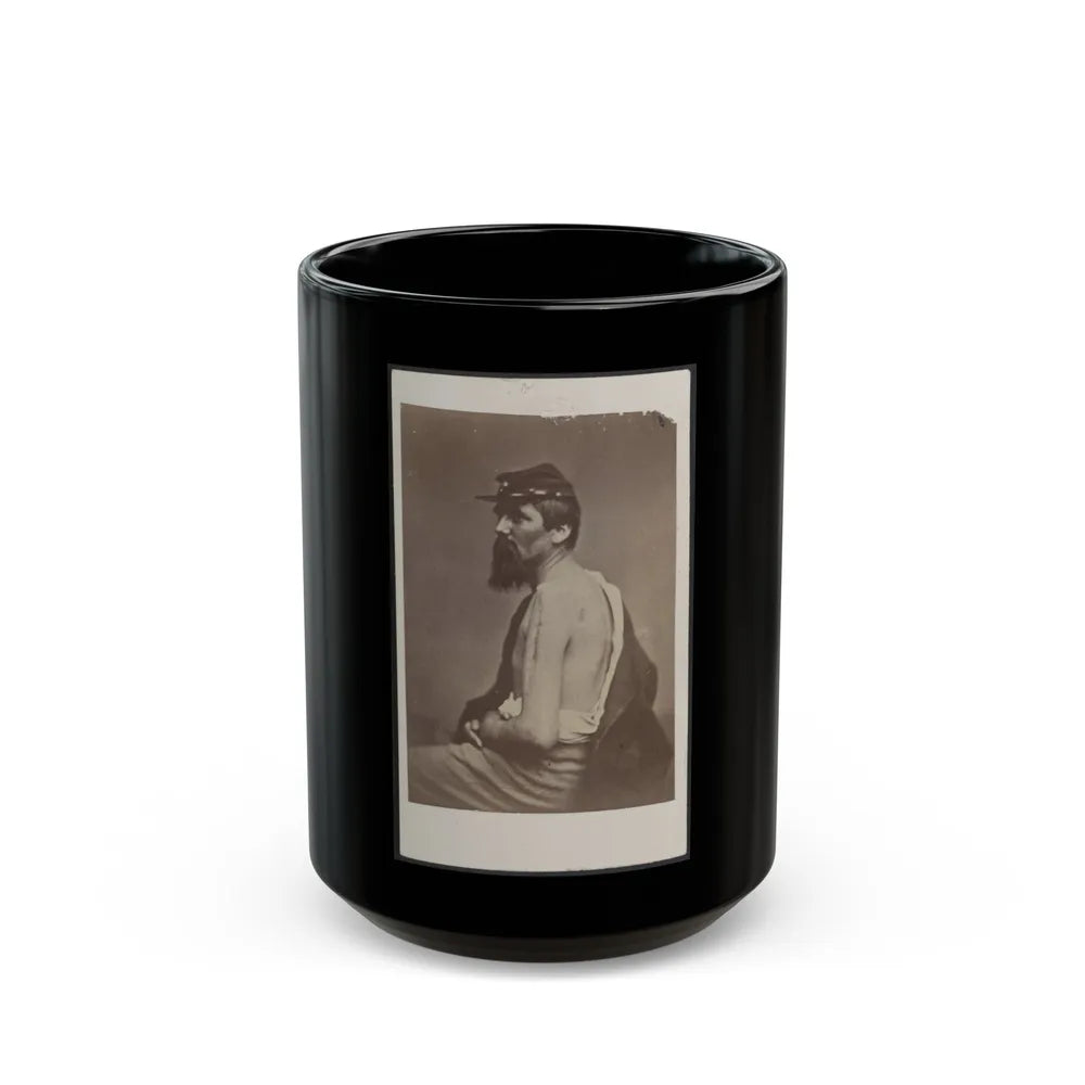 Soldier Named Ewing In Kepi Displaying A Wound To His Arm (U.S. Civil War) Black Coffee Mug-15oz-Go Mug Yourself