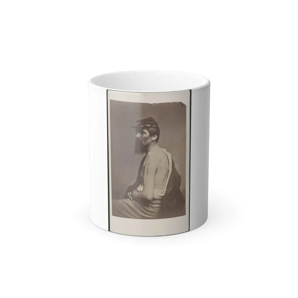 Soldier Named Ewing in Kepi Displaying a Wound to His Arm (U.S. Civil War) Color Changing Coffee Mug 11oz-11oz-Go Mug Yourself