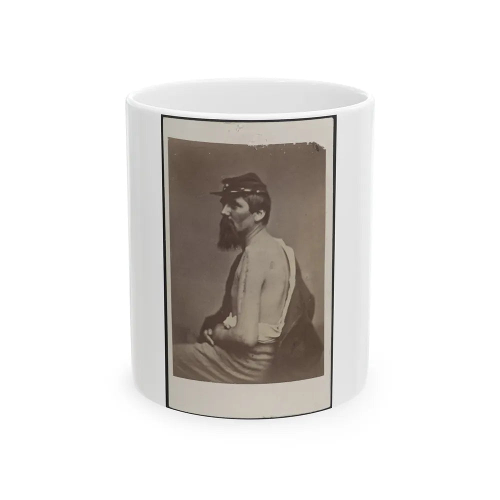 Soldier Named Ewing In Kepi Displaying A Wound To His Arm (U.S. Civil War) White Coffee Mug-11oz-Go Mug Yourself