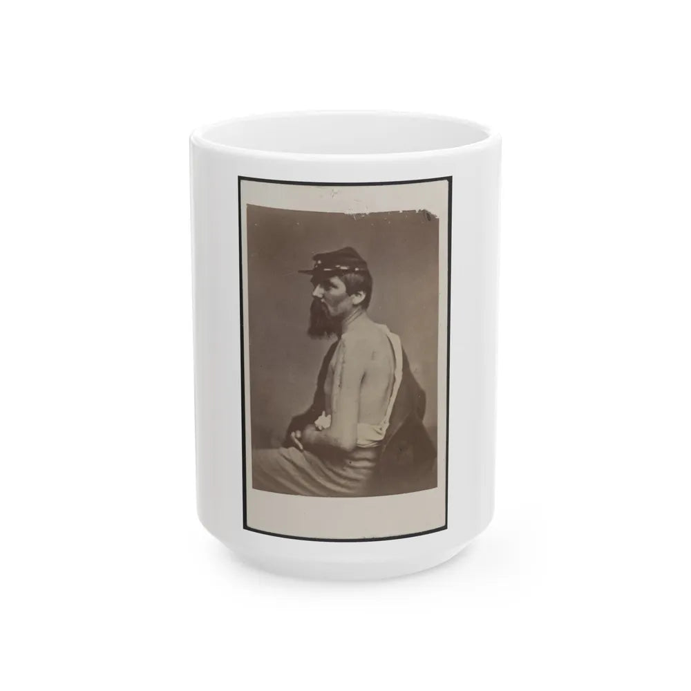 Soldier Named Ewing In Kepi Displaying A Wound To His Arm (U.S. Civil War) White Coffee Mug-15oz-Go Mug Yourself