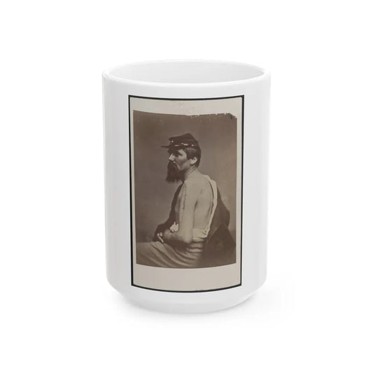 Soldier Named Ewing In Kepi Displaying A Wound To His Arm (U.S. Civil War) White Coffee Mug-15oz-Go Mug Yourself