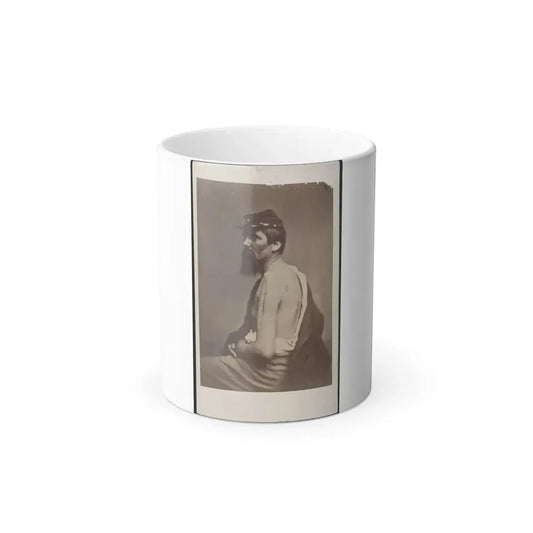 Soldier Named Ewing in Kepi Displaying a Wound to His Arm (U.S. Civil War) Color Changing Coffee Mug 11oz Default Title 11oz - Go Mug Yourself