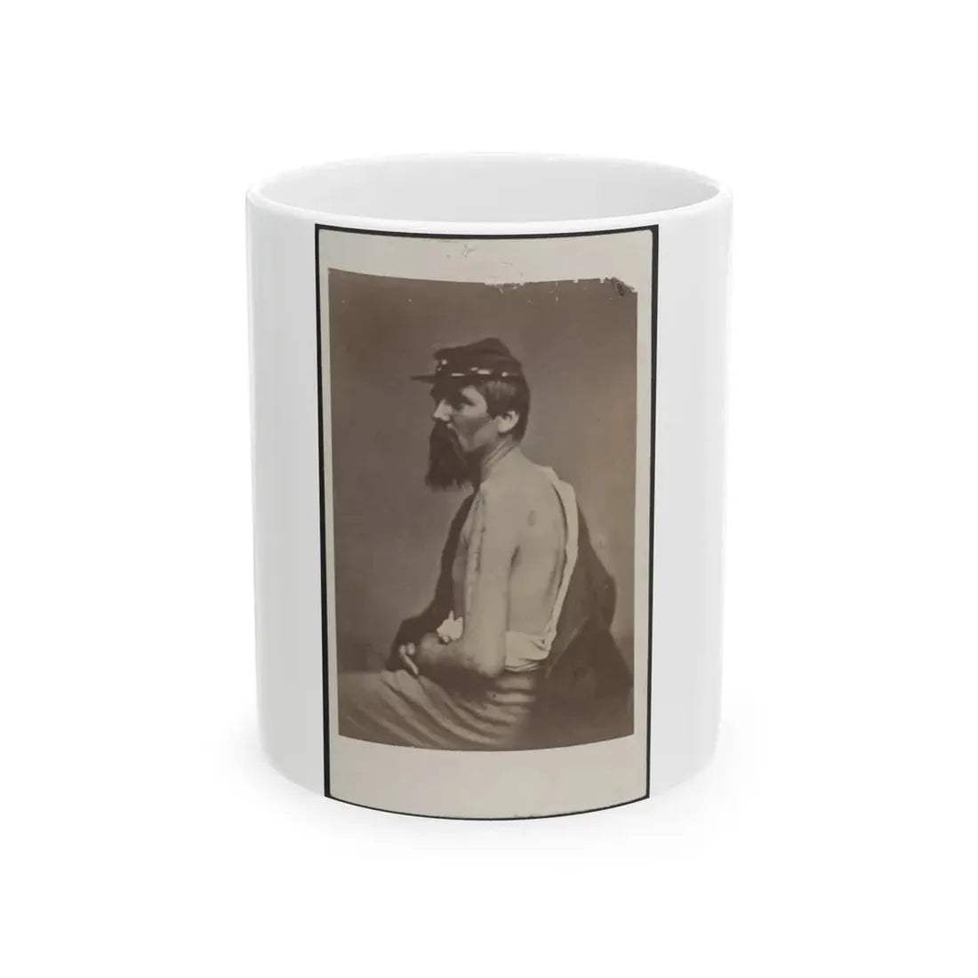 Soldier Named Ewing In Kepi Displaying A Wound To His Arm (U.S. Civil War) White Coffee Mug 11oz - Go Mug Yourself