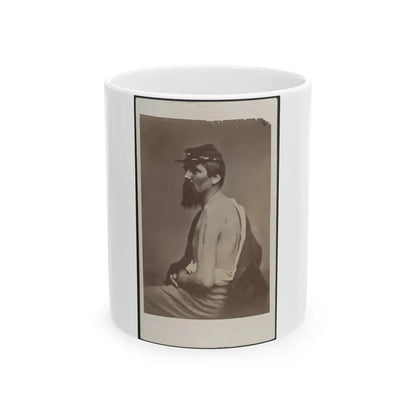 Soldier Named Ewing In Kepi Displaying A Wound To His Arm (U.S. Civil War) White Coffee Mug 11oz - Go Mug Yourself