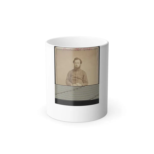 Unidentified Soldier in Union Private's Uniform Displaying His Leg Wound (U.S. Civil War) Color Changing Coffee Mug 11oz-11oz-Go Mug Yourself